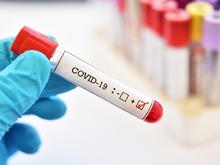Շարունակվում են COVID-19-ի դեմ կանխարգելիչ պատվաստումները